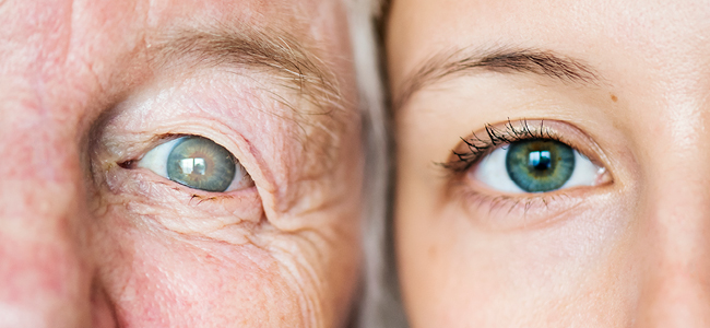 Cataracts: Symptoms And Causes