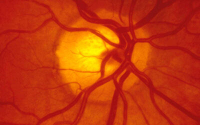 What Can You Interpret From A Retinal Photograph?